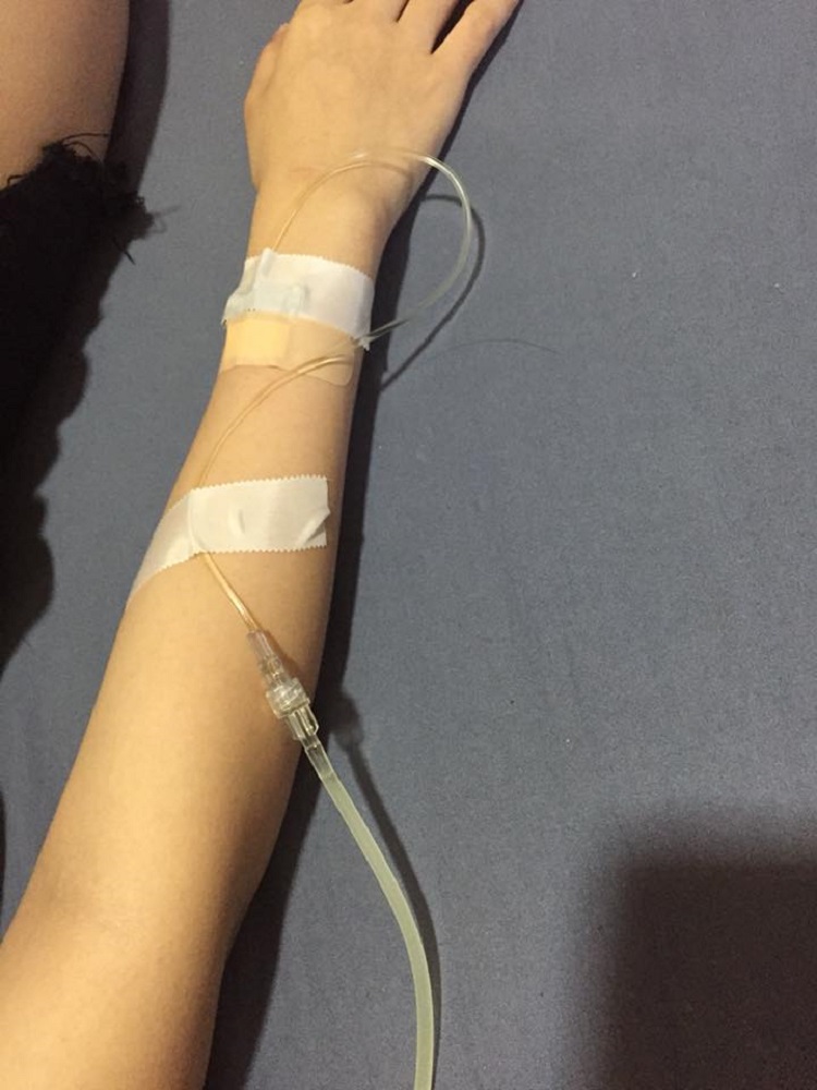 Hình ảnh truyền nước biển ở tay 