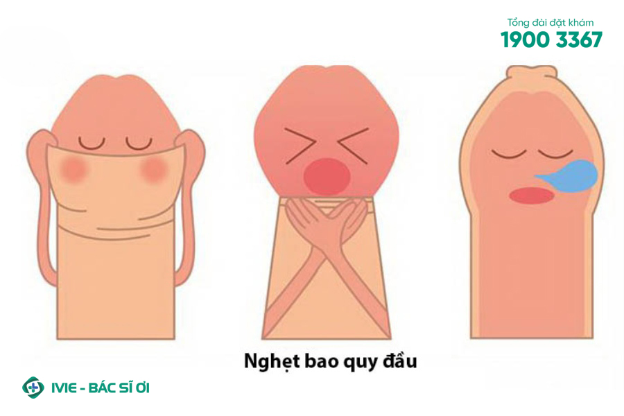 Bao quy đầu quá hẹp hoặc bị nghẹt gây khó khăn trong vệ sinh
