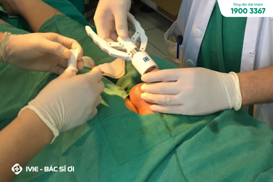 15 tuổi có nên cắt bao quy đầu? Có ảnh hưởng gì không?