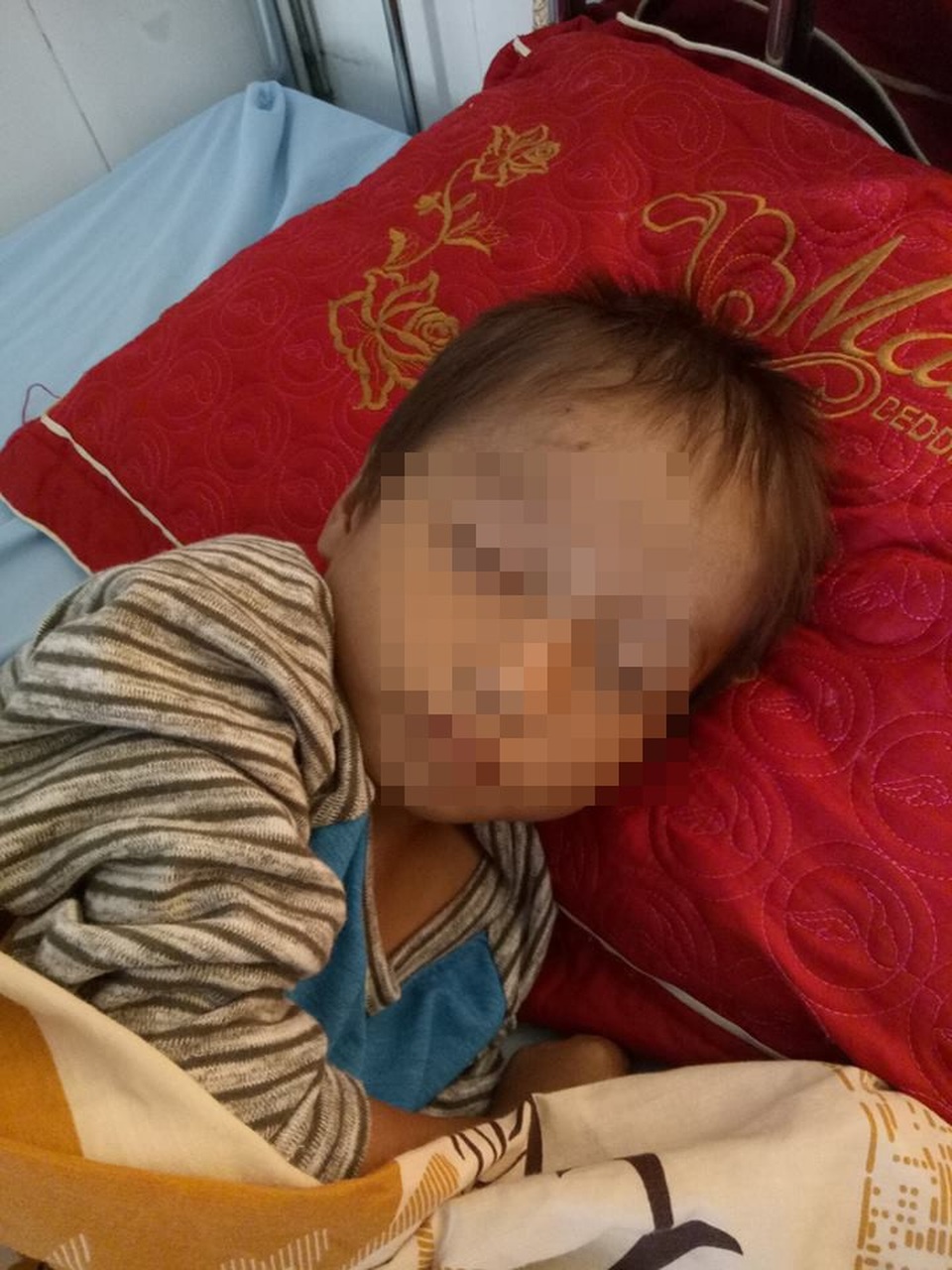 Hiện tại cháu H. được đưa vào Bệnh viện đa khoa huyện Mèo Vạc để điều trị suy dinh dưỡng nặng và bệnh giun sán (Ảnh: Ngọc Hồng).