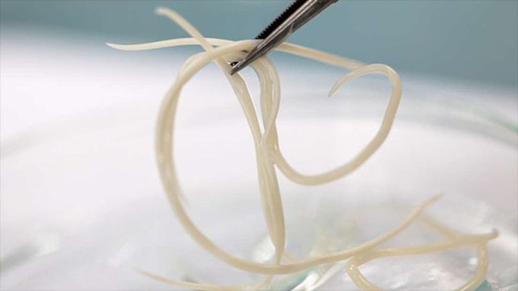 Ký sinh trùng là gì? Ký sinh trùng sinh sản và phát triển thế nào?