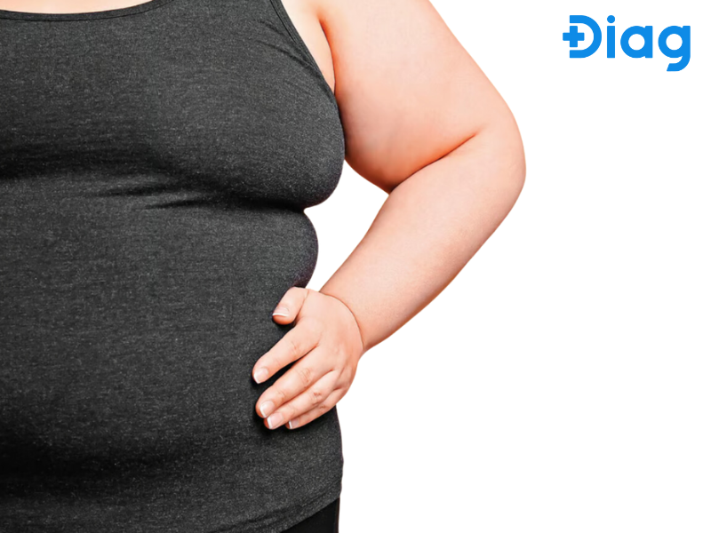 Tiêu thụ quá nhiều chất béo động vật có thể dẫn đến béo phì