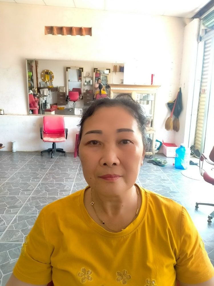 Ca phẫu thuật co giật nửa mặt thành công đem lại chất lượng cuộc sống cho bệnh nhân