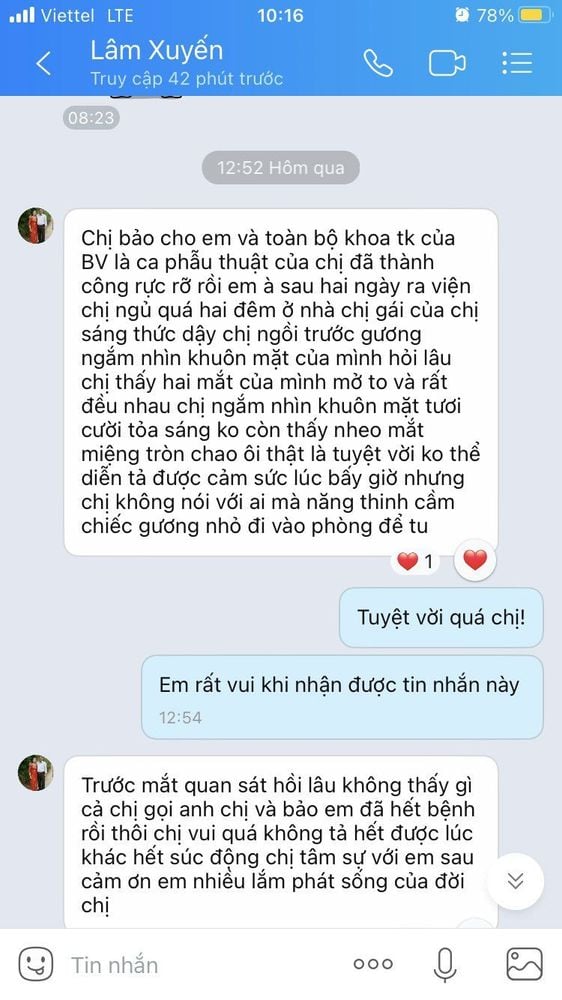 Ám ảnh 23 năm thanh xuân co giật nửa mặt