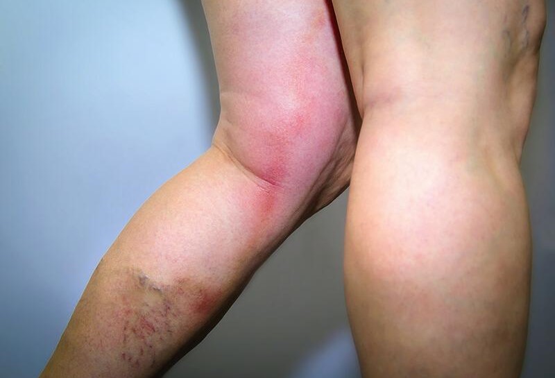 Cấp độ 4 (hình ảnh mang tính minh họa)