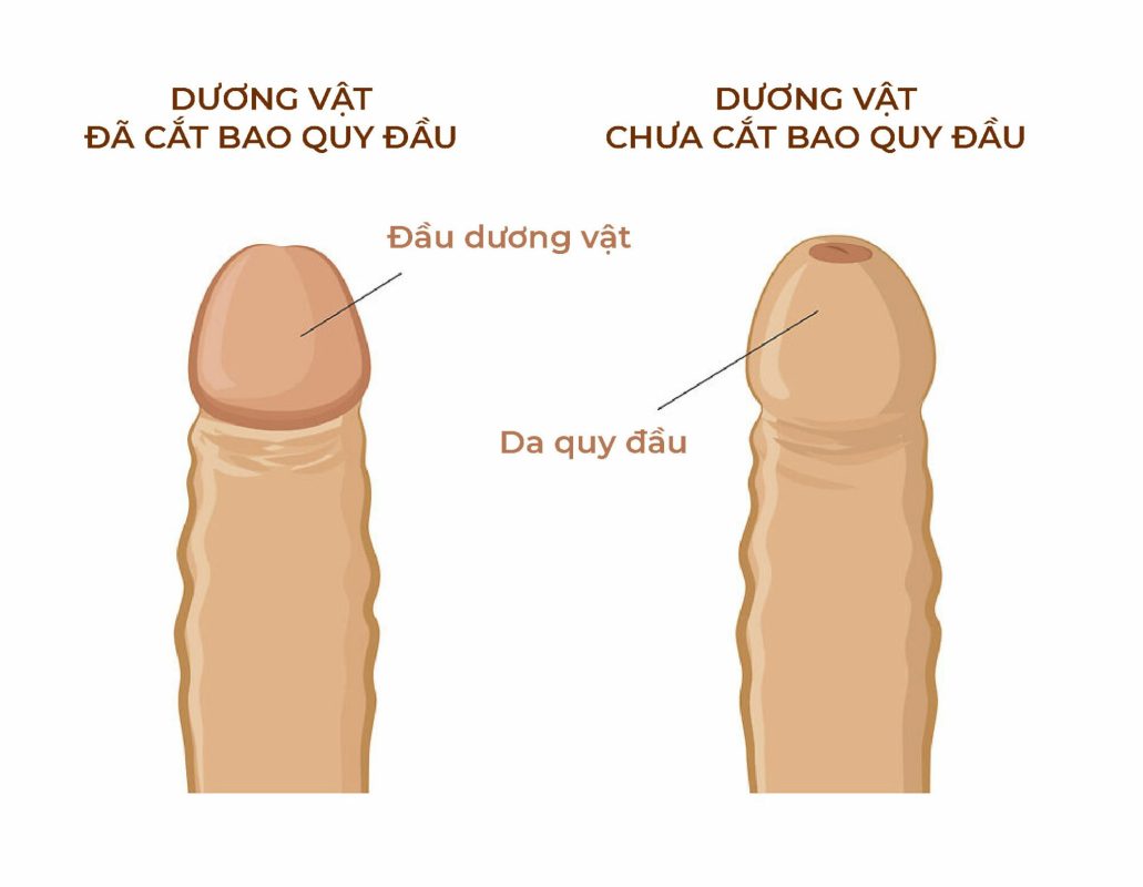 Hình ảnh bộ phận sinh dục bé trai bình thường và bất thường