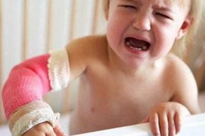 Hầu hết các trường hợp gãy xương là do chấn thương nhẹ đến trung bình