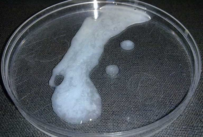 Chất lượng tinh trùng tốt gồm những yếu tố nào? Giải đáp từ chuyên gia