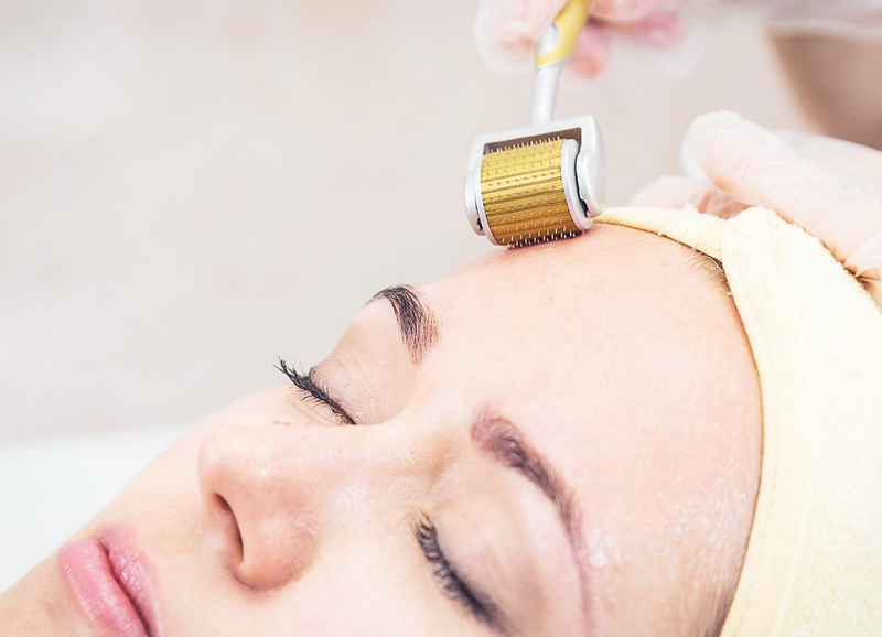 Lăn kim bao nhiêu tiền? Cơ chế của phương pháp lăn kim