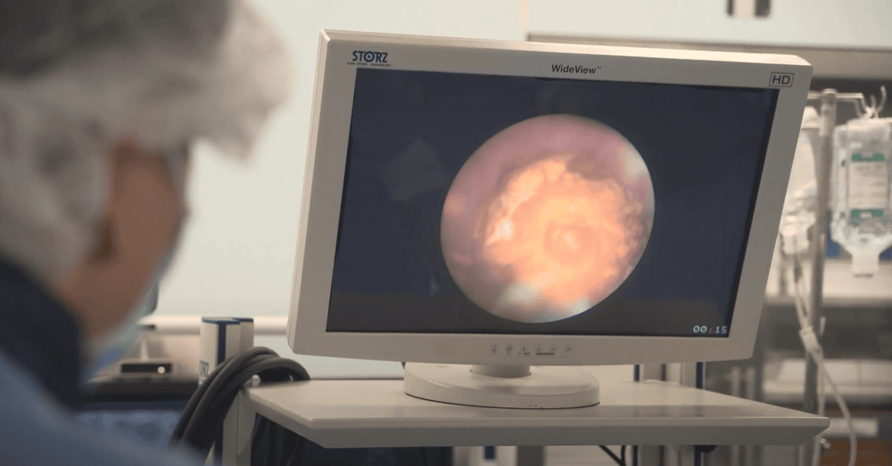 Nội soi dạ dày có mấy cách, được thực hiện như thế nào?