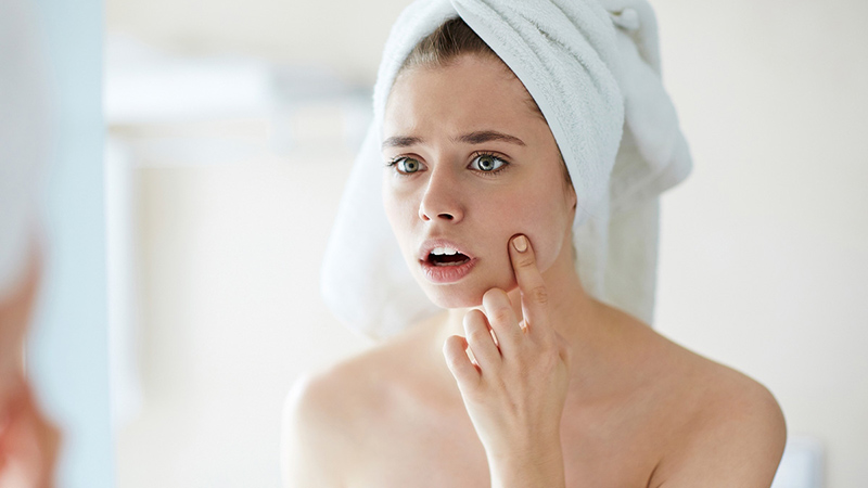 Những lưu ý mà nàng da khô và lỗ chân lông to cần biết