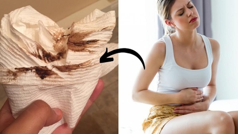 Máu kinh màu nâu có bình thường không? Nên làm gì khi máu kinh màu nâu? 1