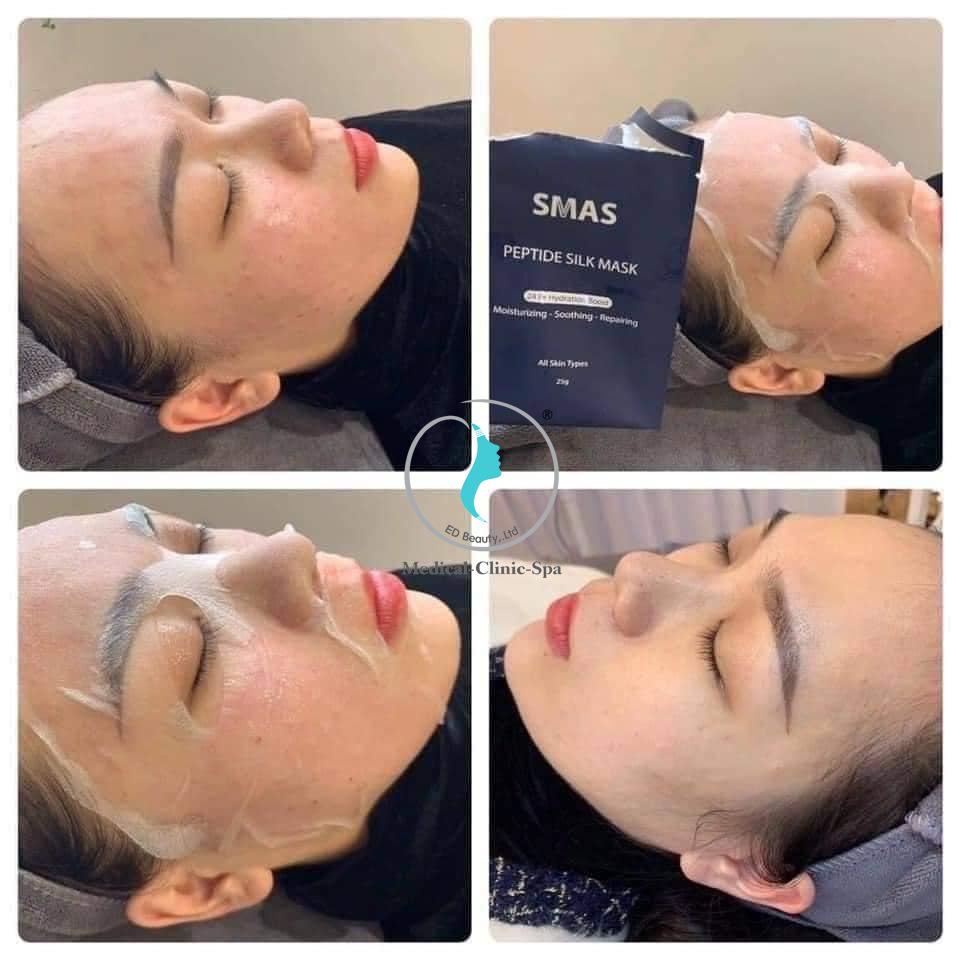 Công dụng của mặt nạ cấp ẩm và dịu da Smas Peptide Silk Mask