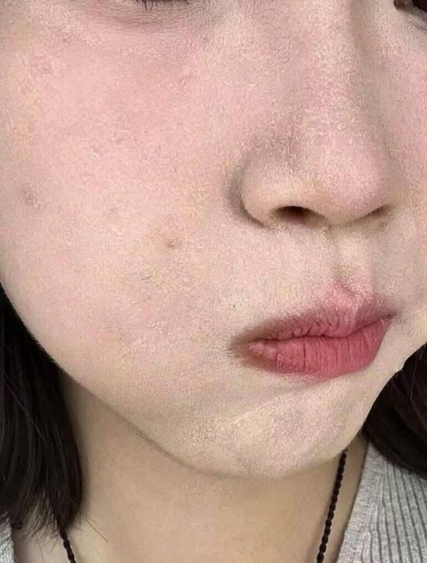 Vì sao đánh nền bị mốc? Phân biệt mốc nền và trượt nền