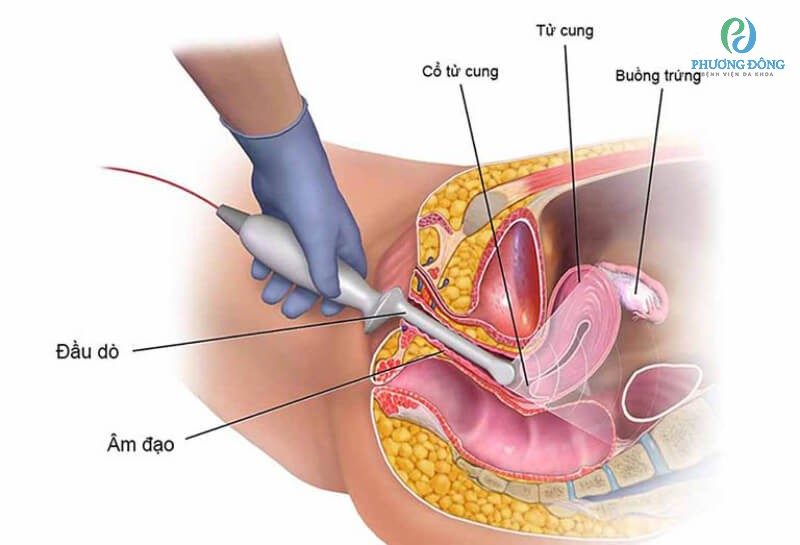 Chẩn đoán bệnh dựa vào các xét nghiệm máu và nước tiểu