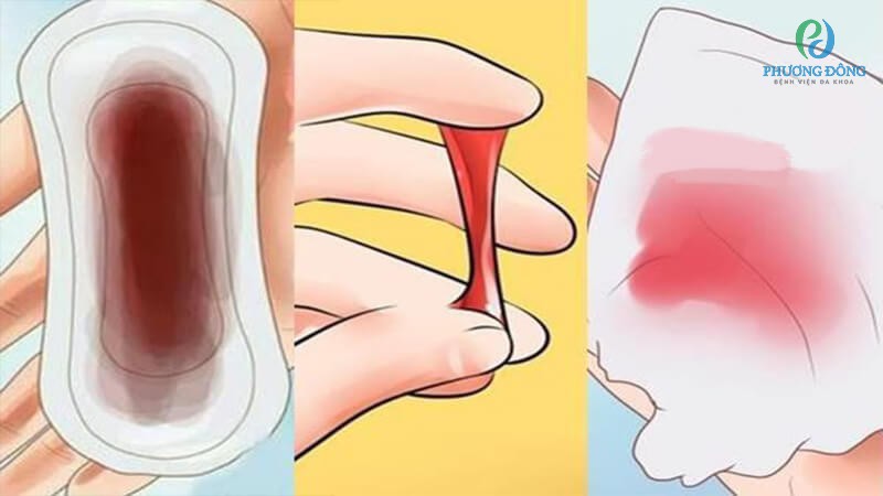 Các bác sĩ sẽ đưa ra phác đồ điều trị với từng trường hợp cụ thể