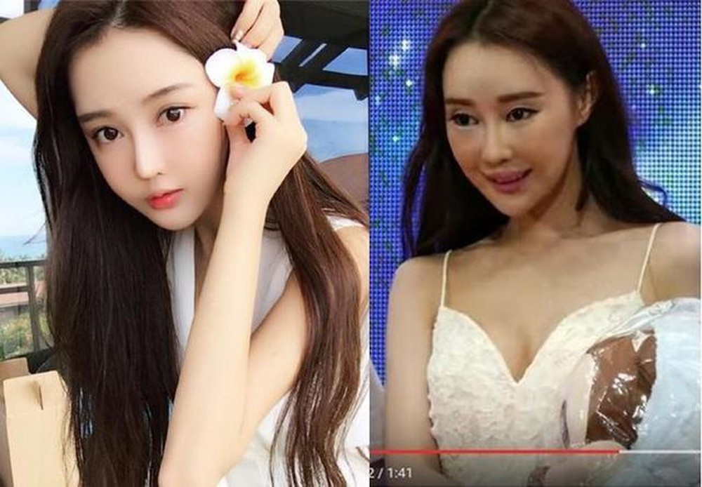 chinh sua qua da anh 3