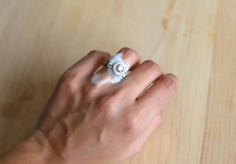 Cách tháo nhẫn khi tay bị sưng bằng chất bôi trơn