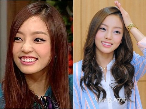 Con gái cười hở lợi thì sao