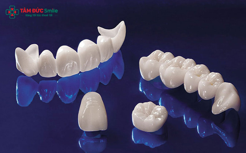 Răng sứ Cercon là dòng sứ cao cấp toàn sứ, không chứa kim loại, có độ trong tự nhiên như răng thật