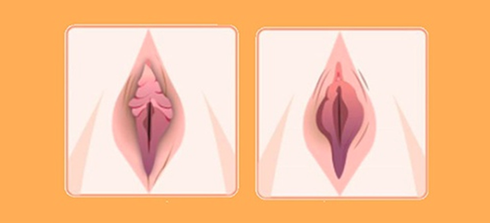 20 Hình ảnh cô bé bị thâm đen và phương pháp khắc phục