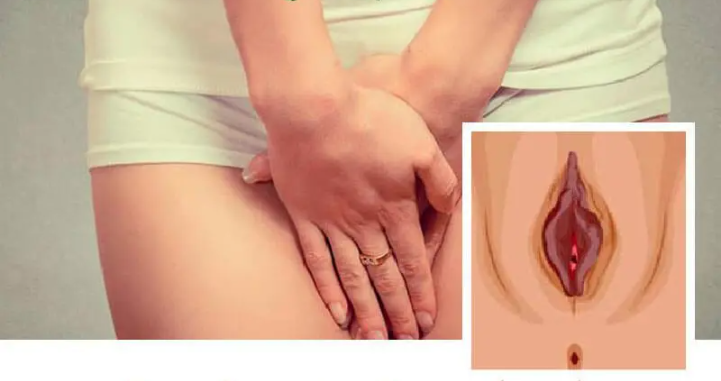 20 Hình ảnh cô bé bị thâm đen và phương pháp khắc phục