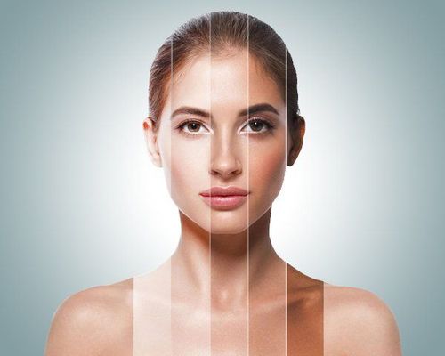 Hydroquinone là gì? Công dụng, liều dùng và tác dụng phụ