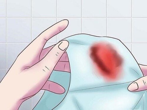 Nếu bạn ra dịch màu nâu đen sau kỳ kinh nguyệt thì đó có thể là máu còn sót lại của kỳ kinh