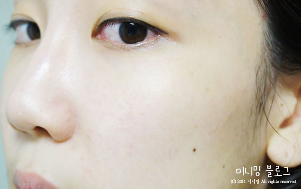 Serum GoodnDoc Hỗ Trợ Sáng Da, Cấp Ẩm GoodnDoc Hydrat B5 Serum 30ml