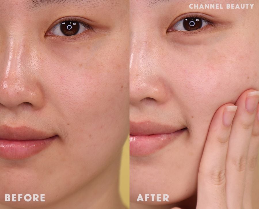 Gel Rửa Mặt Vichy Cho Da Dầu Mụn Làm Sạch Sâu, Giảm Nhờn Normaderm Phytosolution Intensive Purifying Gel