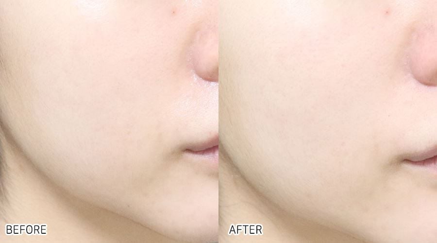 Gel Rửa Mặt Vichy Cho Da Dầu Mụn Làm Sạch Sâu, Giảm Nhờn Normaderm Phytosolution Intensive Purifying Gel