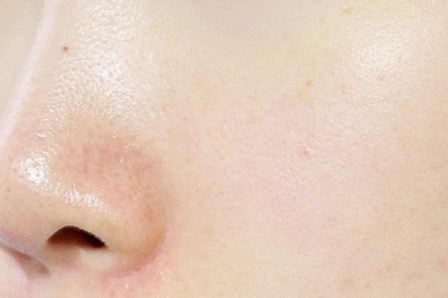 Gel Rửa Mặt Vichy Cho Da Dầu Mụn Làm Sạch Sâu, Giảm Nhờn Normaderm Phytosolution Intensive Purifying Gel