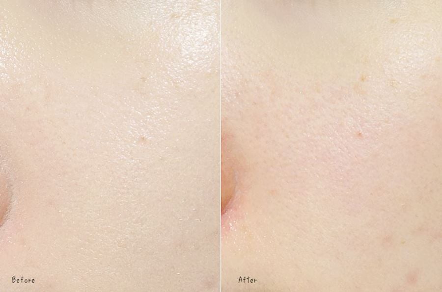 Gel Rửa Mặt Vichy Cho Da Dầu Mụn Làm Sạch Sâu, Giảm Nhờn Normaderm Phytosolution Intensive Purifying Gel