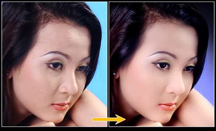 bài tập chỉnh sửa da mặt