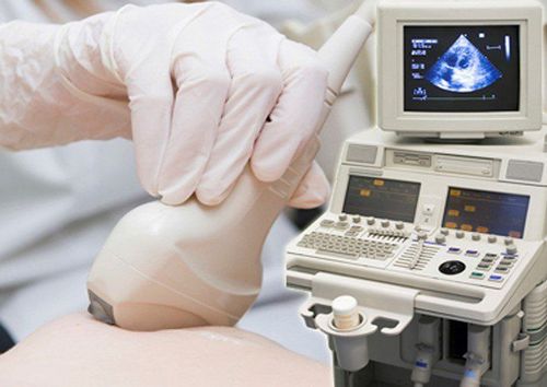 Siêu âm vú giúp chuẩn đoán và đánh giá khối u vú