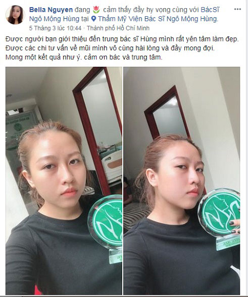 Hình ảnh núm vú bị tụt vào trong